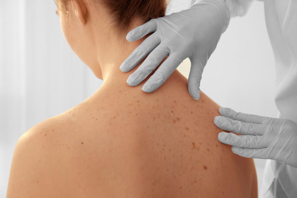 Photo for Freeport Skin Screening (by appointment only)