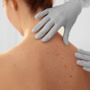 Photo for Woodsfield Skin Screening (by appointment only)